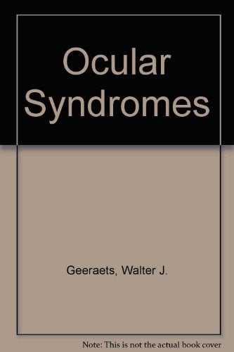 Ocular syndromes