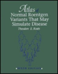 Atlas of Normal Roentgen Variants That May Stimulate Disease