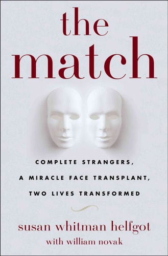 The Match: Complete Strangers, a Miracle Face Transplant, Two Lives Transformed