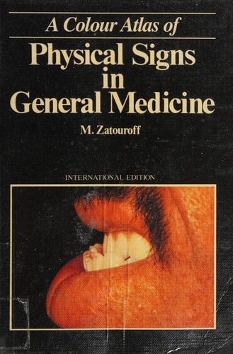 Color Atlas of Physical Signs in General Medicine (Wolfe Medical Atlases)