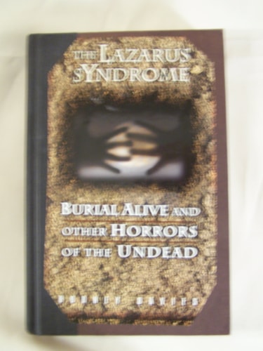 The Lazarus syndrome: Burial alive and other horrors of the undead