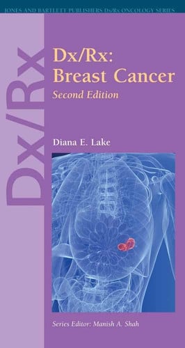 Dx/Rx: Breast Cancer: Breast Cancer (Dx Rx Oncology Series)