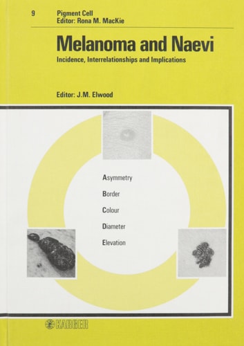 Melanoma and Naevi: Incidence, Interrelationships and Implications (Pigment Cell, Vol. 9) (v. 9)