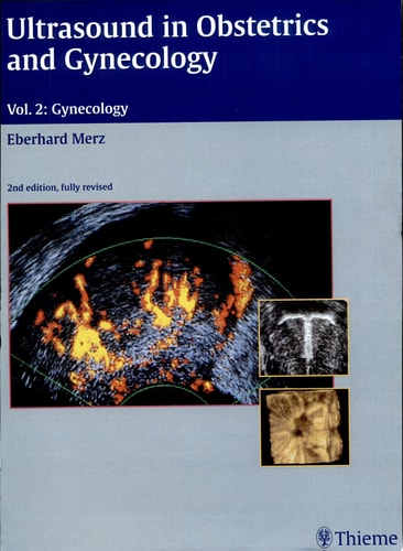 Ultrasound in Obstetrics and Gynecology: Volume 2: Gynecology