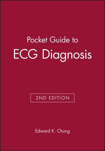Pocketguide to ECG Diagnosis
