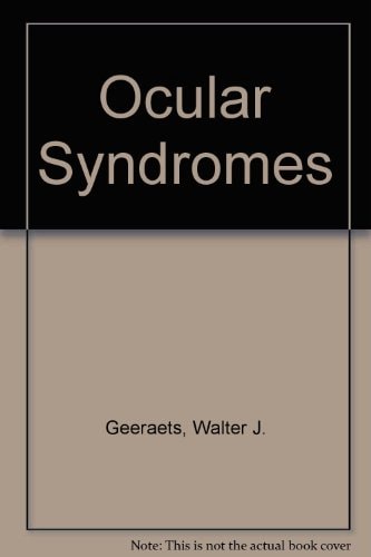 Ocular syndromes