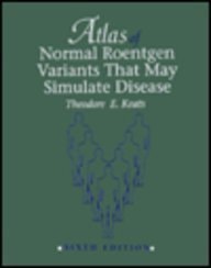 Atlas of Normal Roentgen Variants That May Stimulate Disease