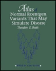 Atlas of Normal Roentgen Variants That May Stimulate Disease