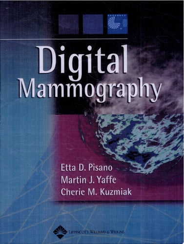 Digital Mammography