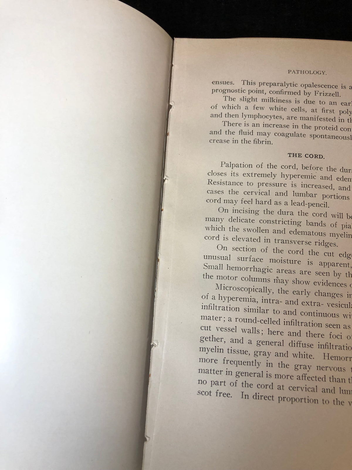 A Manual of Infantile Paralysis - Henry W. Frauenthal and Jacolyn Van Vliet Manning - 1914